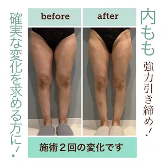 エステサロン JURISのエステ・リラクイメージ