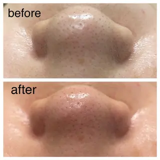 Reid-月詠-所属・Reid -月詠-のエステ・リラクイメージ