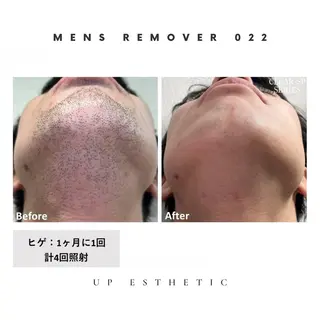 メンズ ウプエステティック所属・韓国肌管理 ウプエステティックのエステ・リラクイメージ