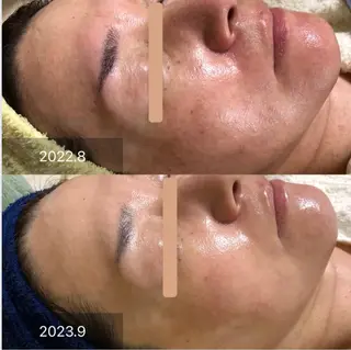 Chio-RE所属・Wax/絹肌艶肌🌼 坂結加のエステ・リラクイメージ