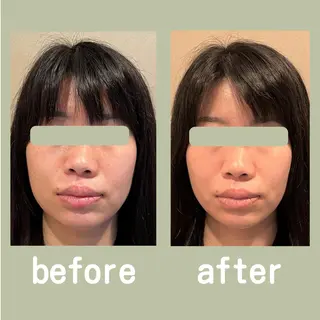 美容鍼灸サロン      APLUS所属・美容鍼灸サロン APLUSのエステ・リラクイメージ