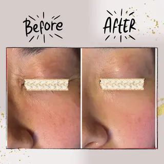 ピーリング専門店 Belluteのエステ・リラクイメージ