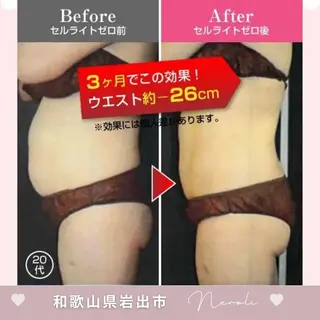 温活beautyサロンNeroli所属・切らない脂肪吸引🔥 Neroliまりこのエステ・リラクイメージ