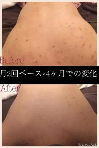 ミディアム カラー パーマ ヘアアレンジ メンズ キッズ ネイル マツエク・マツパ ニキビ・肌質改善専門 ♡人生が変わるサロンのエステ・リラクイメージ