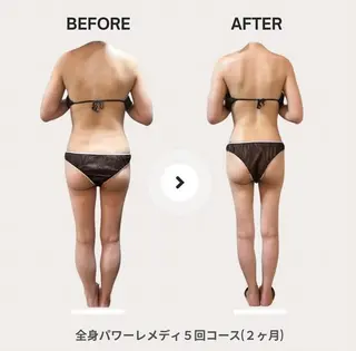 biloop所属・《痩身×疲労改善》 BILOOPのエステ・リラクイメージ