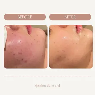 サロンドゥ ルシエルのエステ・リラクイメージ