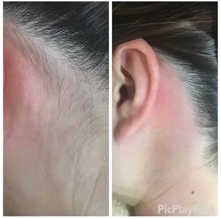 エステ矢野 ジョアアンジェ心斎橋のエステ・リラクイメージ