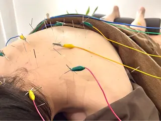 Spring鍼灸院所属・Spring鍼灸院 ✨首肩こり、腰痛に！のその他イメージ