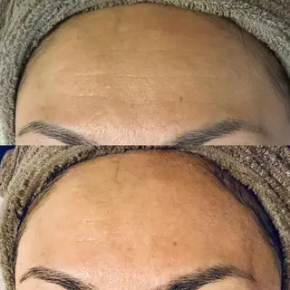 大名 Kalon（カロン）のエステ・リラクイメージ