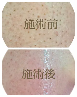 美肌脱毛サロン つるりと御殿場店所属・美肌脱毛サロン つるりとのその他イメージ