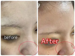 いおもり あやかのエステ・リラクイメージ