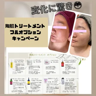 Nadia〜body &facial salon〜所属・【肌質改善】 ハーブピーリングのエステ・リラクイメージ
