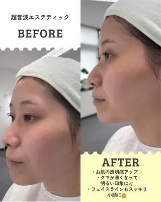 skinLabo所属・saya Mのエステ・リラクイメージ