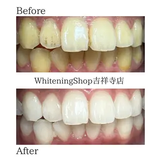 ホワイトニング ショップ吉祥寺店のエステ・リラクイメージ