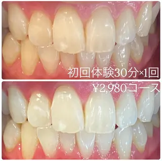 PLATINUM Beauty 横浜店所属・ホワイトニングルーム 横浜店のその他イメージ