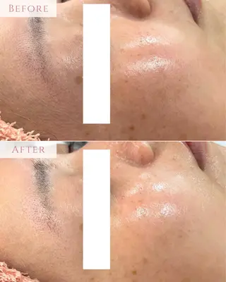 肌質改善専門サロン Bellmi/心斎橋のエステ・リラクイメージ