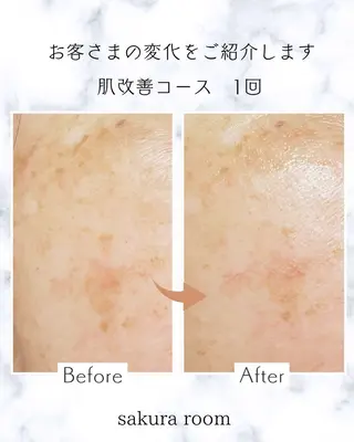 sakura room久我石原のエステ・リラクイメージ