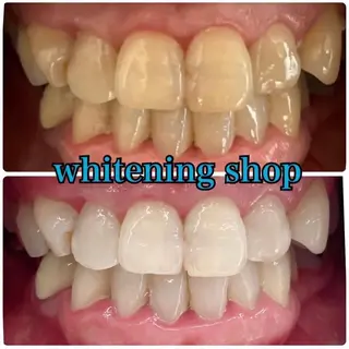 ホワイトニング ショップ吉祥寺店のエステ・リラクイメージ