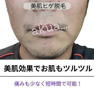 akua... 【肌質管理専門】のその他イメージ
