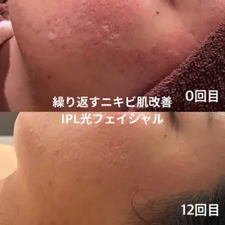 LEPUS【レプス】 sekiのエステ・リラクイメージ