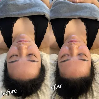 うなじ脱毛/美肌脱毛 LABELのエステ・リラクイメージ