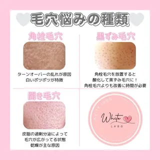 肌管理専門店Whitelabo堺東店所属・おだ あみのエステ・リラクイメージ