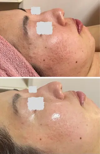 辻村 晴美のエステ・リラクイメージ