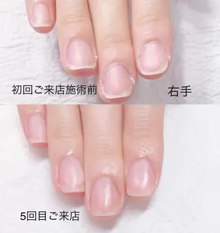 ネイル 北浦和 自爪育成ケアのネイルデザイン