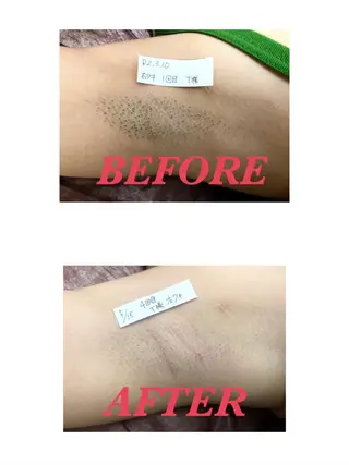 Prima〜プリマ〜 名古屋駅店所属・Prima 痩身脱毛 にごうかおりのエステ・リラクイメージ