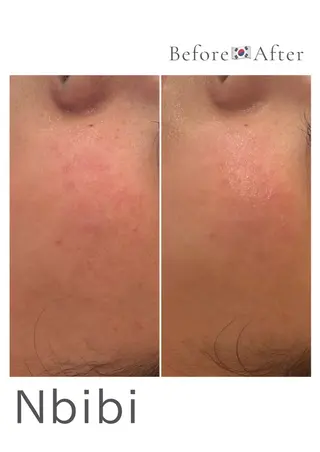 韓国🇰🇷価格 サロン_Nbibiのエステ・リラクイメージ