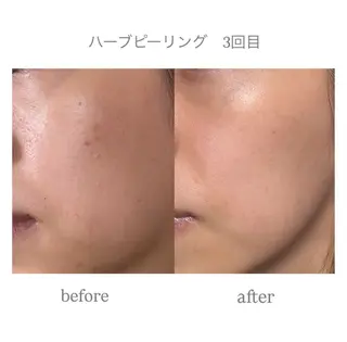 anthes /MIHOのエステ・リラクイメージ