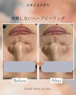 La chic.のエステ・リラクイメージ