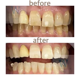 ホワイトニング ショップ船橋店🦷のエステ・リラクイメージ