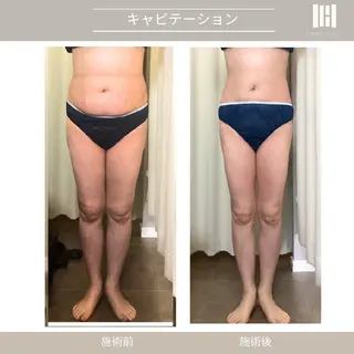 上杉 彩のエステ・リラクイメージ