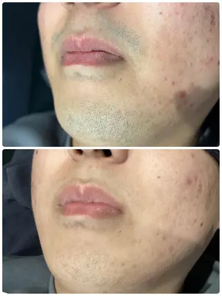 クラスペディア脱毛 ・フェイシャル専門店のエステ・リラクイメージ