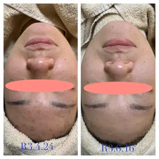 エステティック Nanagiのエステ・リラクイメージ