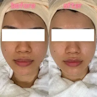 pansy(パンジー)上野フェイシャルエステ専門店所属・pansy saraのエステ・リラクイメージ