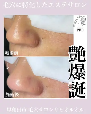 毛穴汚れ改善専門店/ 岸和田/リヒオルオルのエステ・リラクイメージ