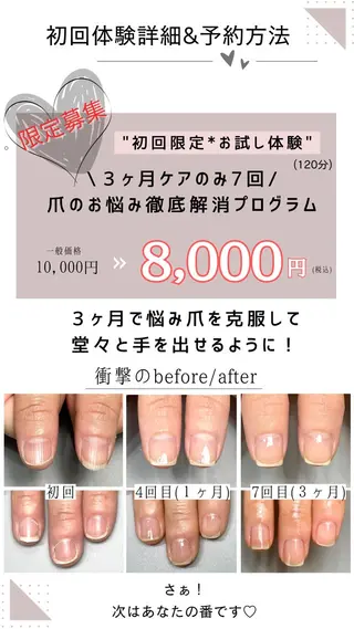 ネイル Aim* 深爪・自爪育成専門店のネイルデザイン