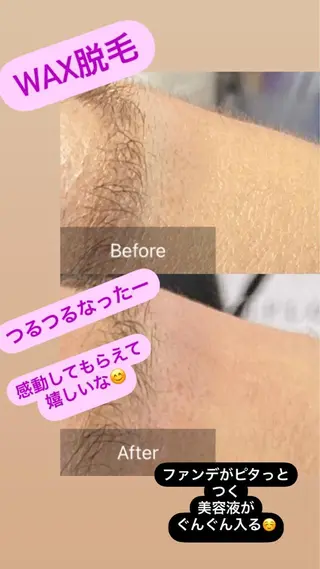 産毛専門店 Bittoのエステ・リラクイメージ