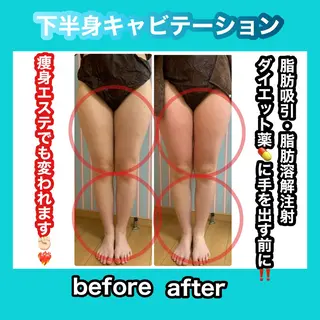 痩身/脱毛/ネイル HARUKAのエステ・リラクイメージ