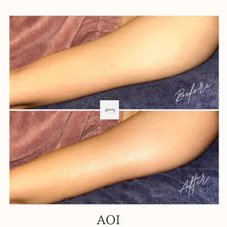 salon shares 辻堂店所属・SHARES AOIのエステ・リラクイメージ