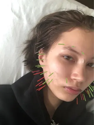 THE  ROOTS所属・美容鍼♡小顔矯正♡ fumikaのエステ・リラクイメージ