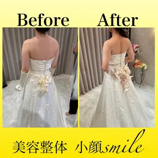 【小顔矯正専門】 小顔smileのエステ・リラクイメージ