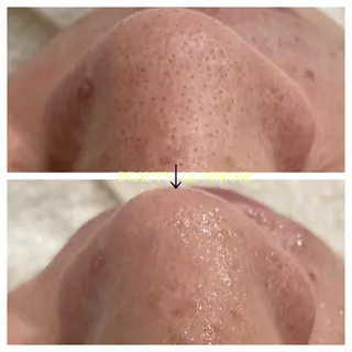 ビューティー ミロワールのエステ・リラクイメージ