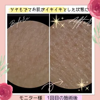 ペルラジョーネ💄 emiのエステ・リラクイメージ