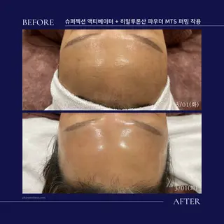 Monreve所属・美人スイッチdiet スーパージェクションのその他イメージ