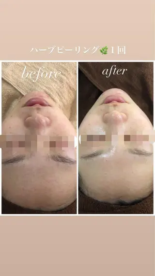 セミロング カラー パーマ ヘアアレンジ メンズ キッズ ネイル マツエク・マツパ Amaryllis 🌹のエステ・リラクイメージ