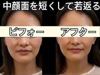 小顔専門看護師クリニカルサロンCOCO所属・小顔と美肌サロン クリニカルサロンココのエステ・リラクイメージ