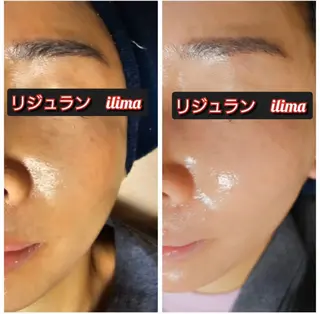 ilima NARUMIのエステ・リラクイメージ